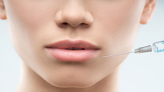 Ce poate face Botox-ul pentru buzele dvs?