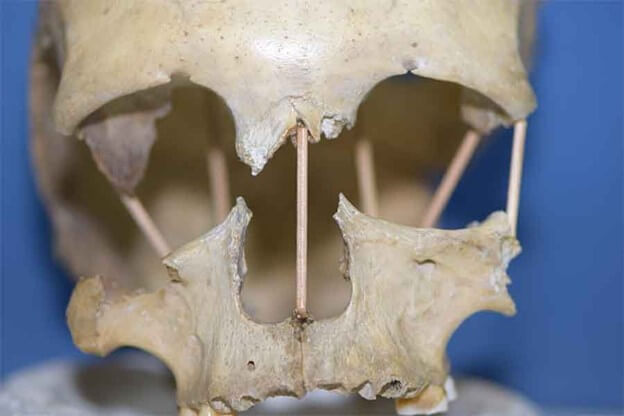 Studiul genetic al craniului romanesc anuleaza teoriile anterioare ale evolutiei